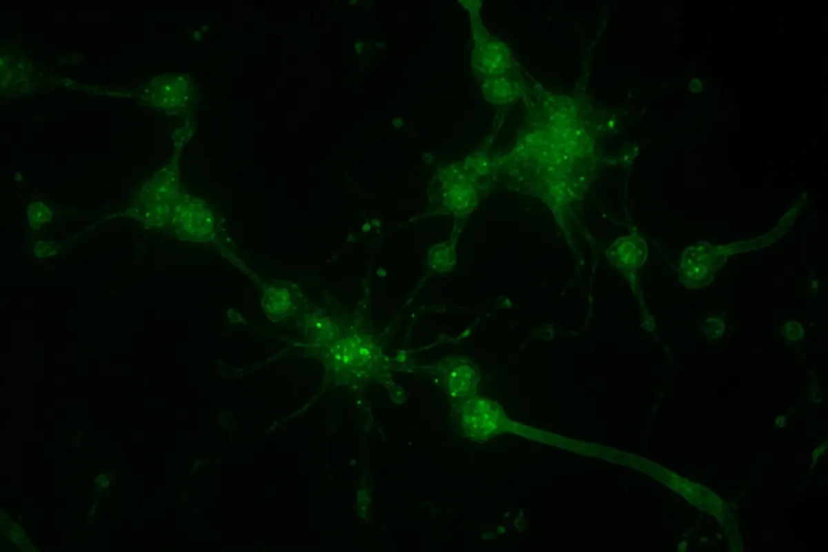 Neuronas de serotonina en el cerebro