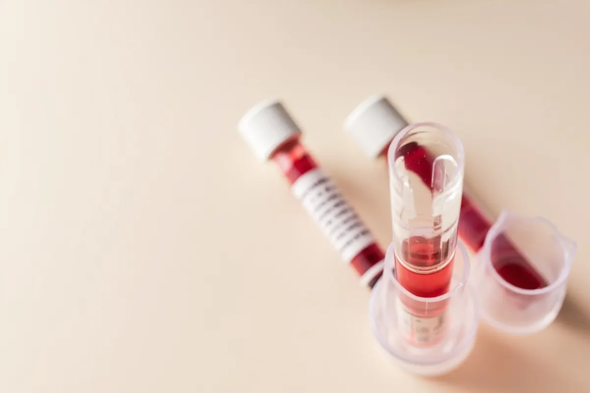 Tubos de sangre para análisis de glucosa y hemoglobina glicada