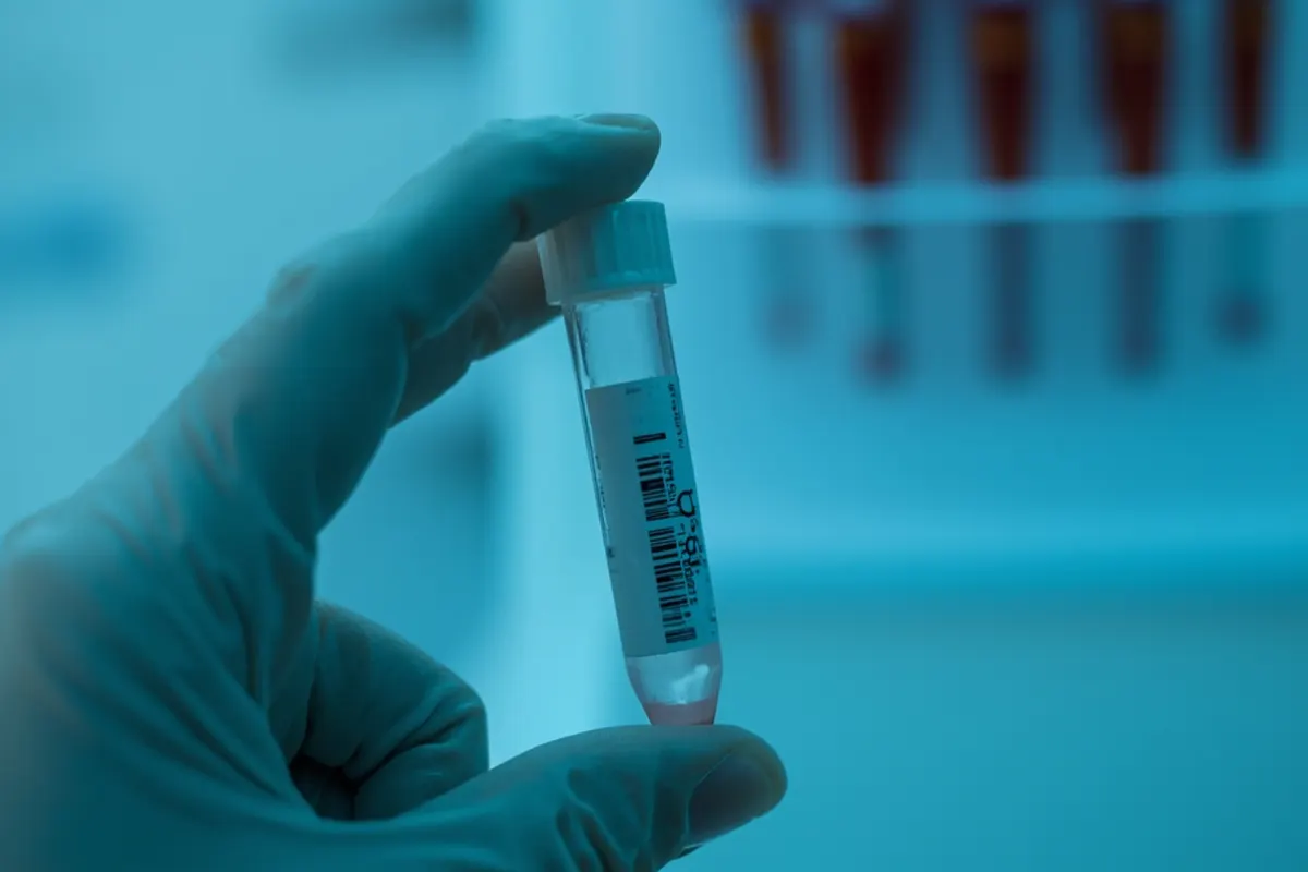 Tubo de sangre para análisis hormonal en una consulta