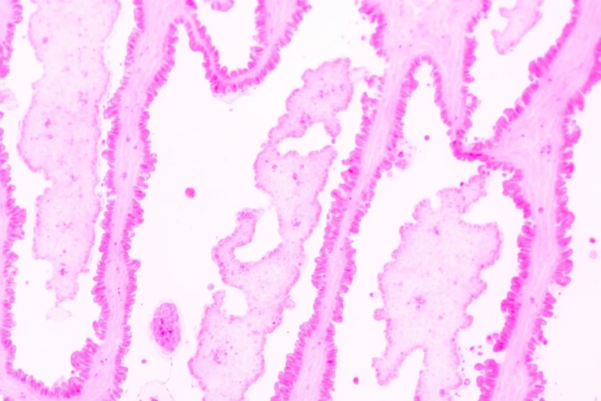 Tejido pulmonar visto al microscopio
