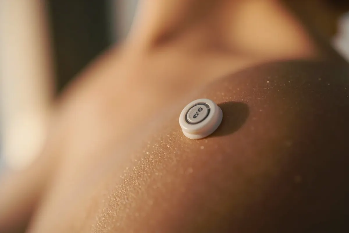 Sensor continuo de glucosa colocado en el brazo